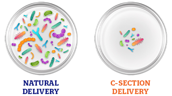 HOW CAN WE HELP C-SECTION KIDS HAVE A GOOD START IN LIFE